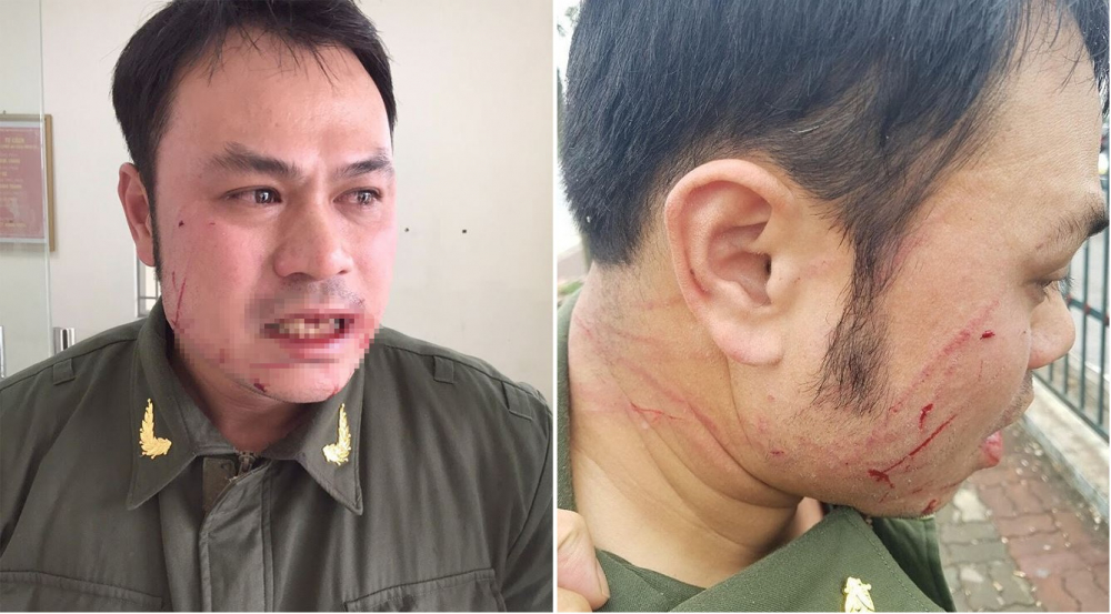 Chân dung cò taxi đánh gãy 4 răng nhân viên an ninh sân bay Nội Bài-2
