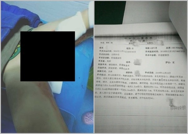 Cháu gái về nhà trong tình trạng máu chảy đầy quần, dì biết chuyện liền báo cảnh sát và hé lộ vụ bạo hành tàn độc ở trường học-2