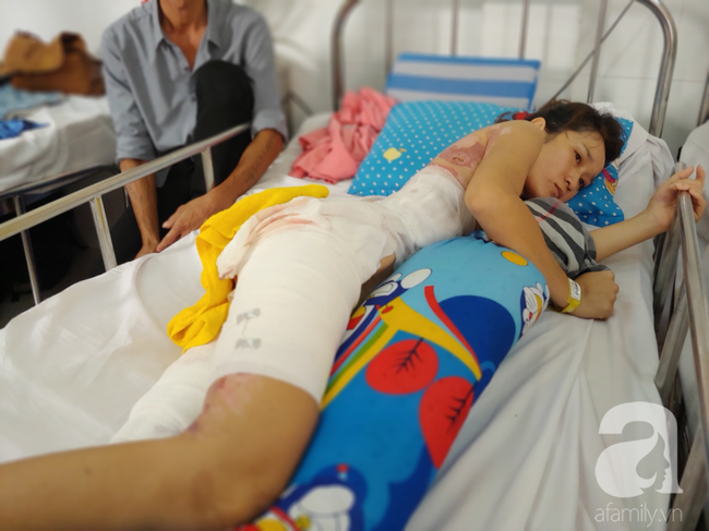 Vợ bị lửa xăng của chồng làm bỏng nặng sau cơn cuồng ghen: Em chỉ muốn làm lại từ đầu với anh ấy”-11