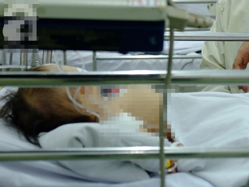 Thương tâm: Bình xăng cũ phát nổ trong đống rác, bé 28 tháng tuổi tử vong vì bỏng nặng