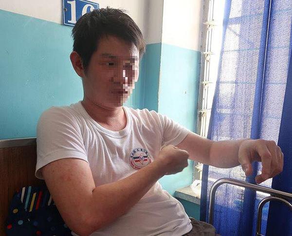 Bệnh sởi gia tăng đột biến ở người lớn, nếu thấy có dấu hiệu này tới viện ngay lập tức-2