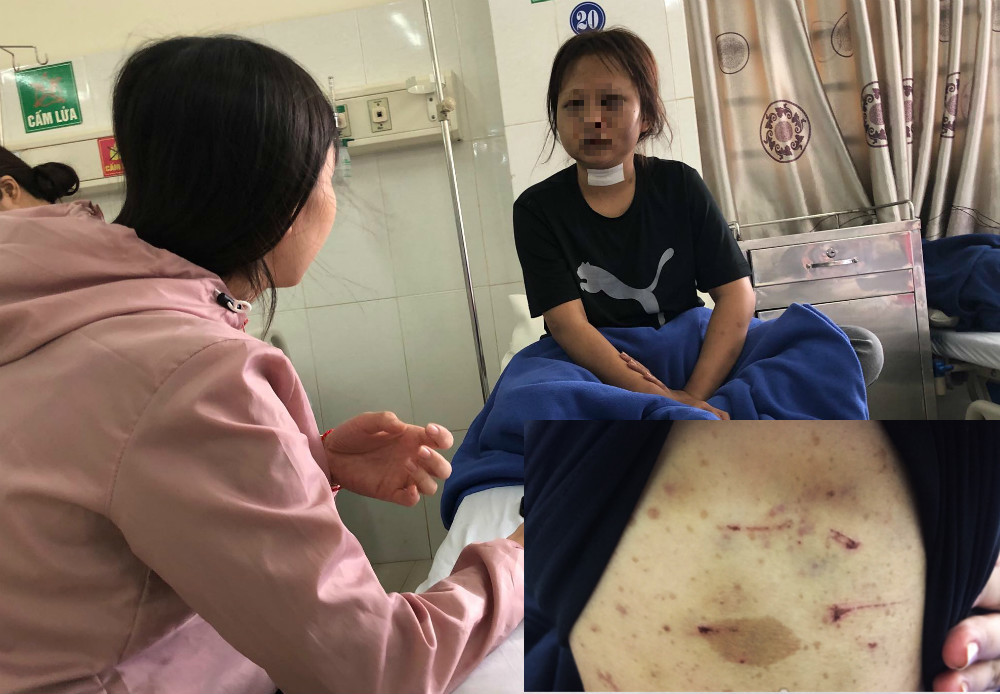 Từ chối tiếp khách, thiếu nữ bị ‘trùm điều đào’ đánh dã man suốt 2 ngày-1