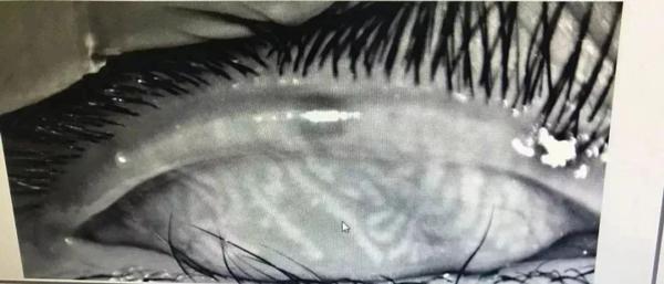 Con không mở nổi mắt phải đi khám, mẹ hối hận khi nghe bí mật động trời của con-2