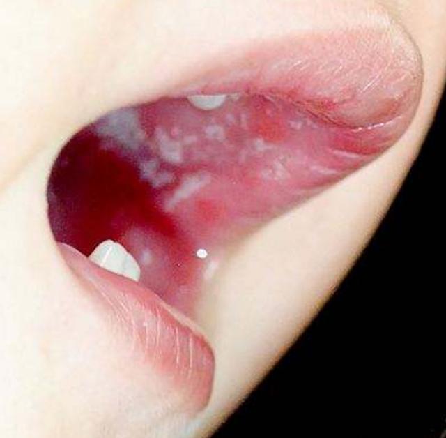 Để con trai ở nhà với ông bà nội, mẹ chết lặng khi bác sĩ nói con phải cắt lưỡi-3