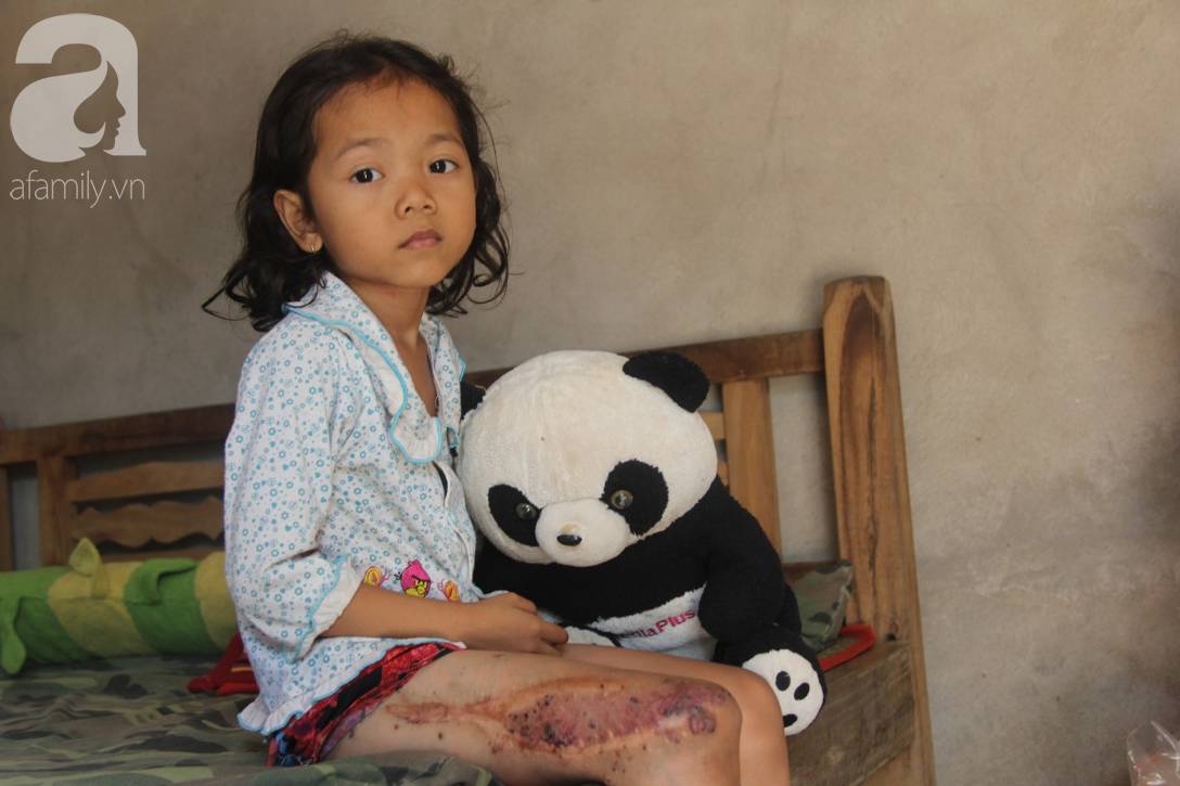 Em quỳ gối xin mọi người cứu lấy con em, không có tiền phẫu thuật bướu máu con bé sẽ chết-1