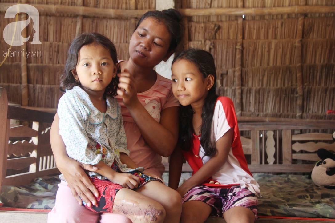 Em quỳ gối xin mọi người cứu lấy con em, không có tiền phẫu thuật bướu máu con bé sẽ chết-14