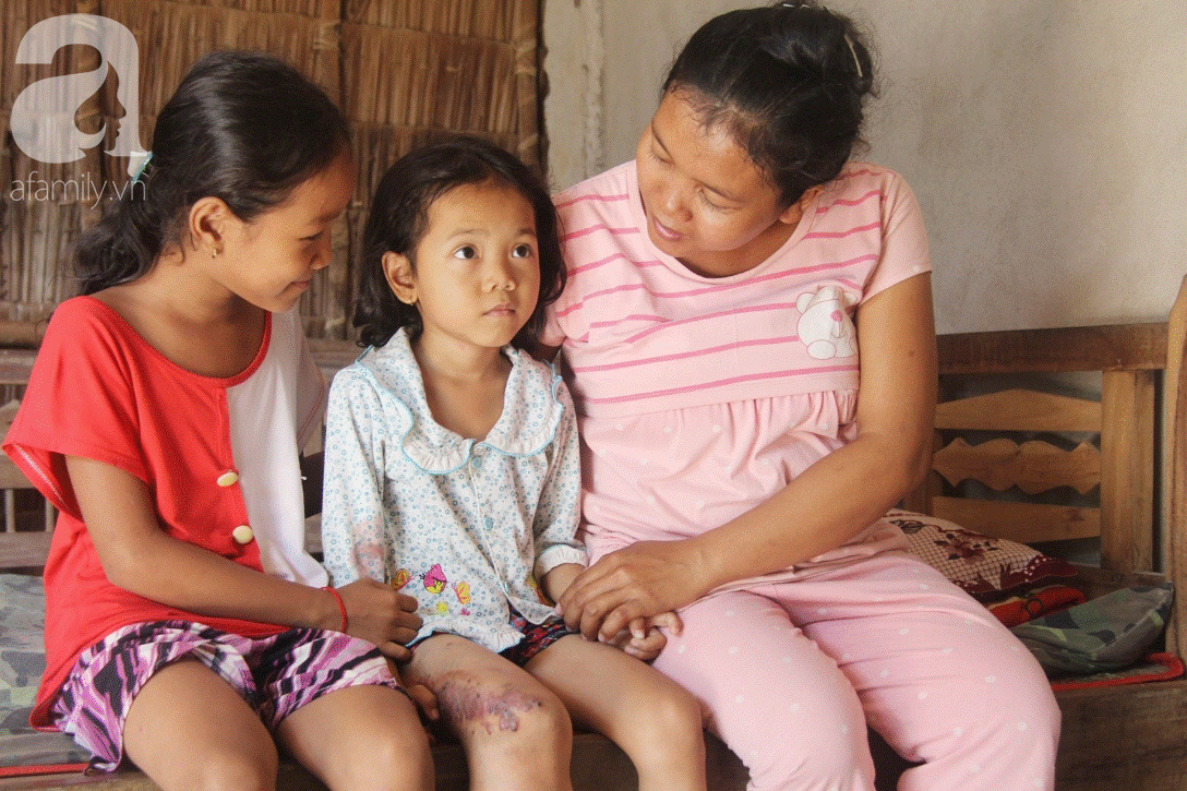 Em quỳ gối xin mọi người cứu lấy con em, không có tiền phẫu thuật bướu máu con bé sẽ chết-18