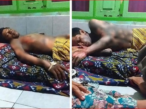 Indonesia: Vợ tẩm xăng thiêu chồng vì không chịu đưa mật khẩu điện thoại