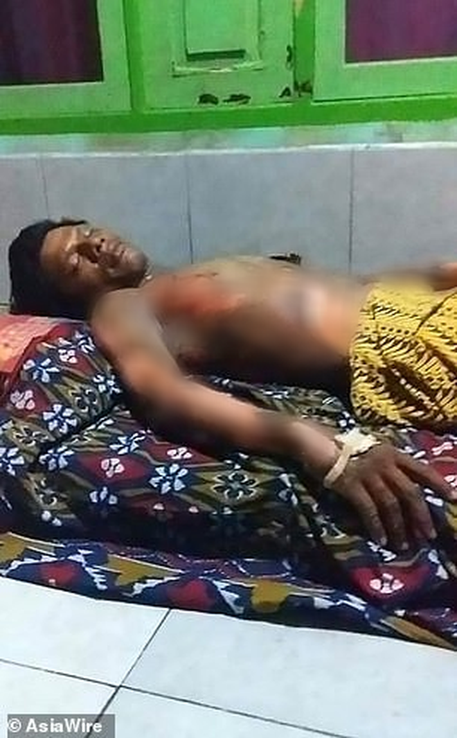 Indonesia: Vợ tẩm xăng thiêu chồng vì không chịu đưa mật khẩu điện thoại-3