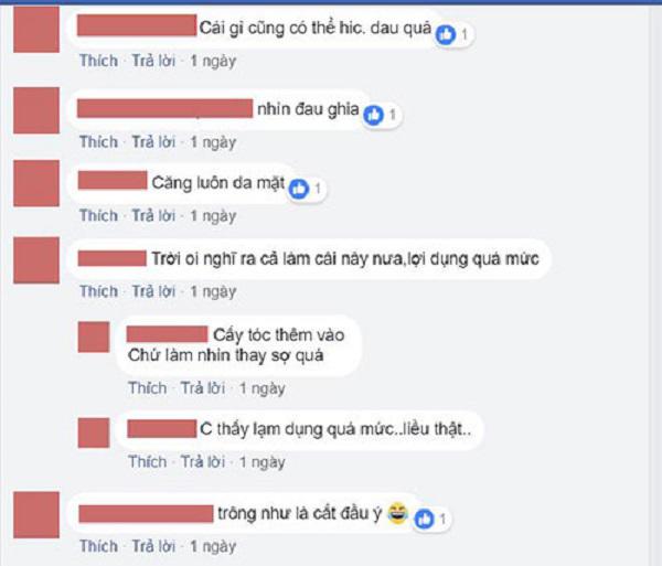 Sửa mũi cắt môi đã là gì, chị em bây giờ còn rủ nhau đi cắt da đầu để...-5