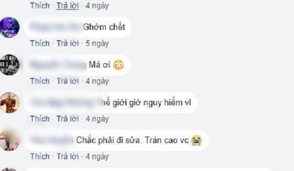 Sửa mũi cắt môi đã là gì, chị em bây giờ còn rủ nhau đi cắt da đầu để...-6