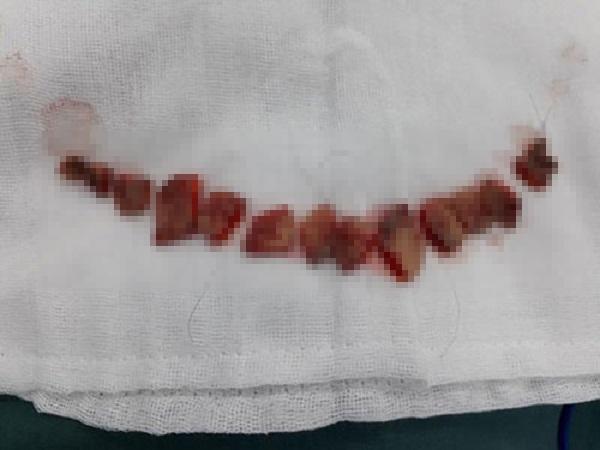 Sửa mũi cắt môi đã là gì, chị em bây giờ còn rủ nhau đi cắt da đầu để...-3