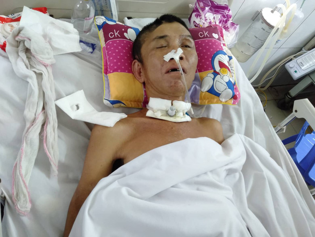 Nghệ An: Con trai 2 tuổi sợ hãi khóc thét sau 2 tháng gặp lại bố bị tai nạn giao thông-3