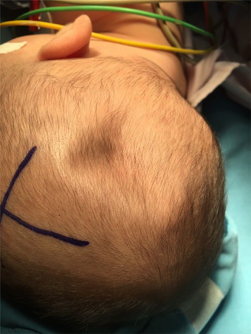 Cảnh giác với tình trạng chấn thương đầu của trẻ do té ngã-1