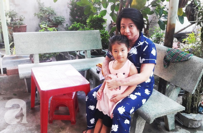 Người vợ bị chồng dùng xăng đốt vì níu kéo tình cảm không thành: Tết này em được về với con rồi-1