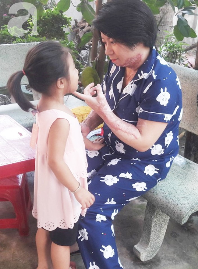 Người vợ bị chồng dùng xăng đốt vì níu kéo tình cảm không thành: Tết này em được về với con rồi-12