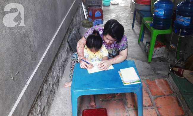 Người vợ bị chồng dùng xăng đốt vì níu kéo tình cảm không thành: Tết này em được về với con rồi-5