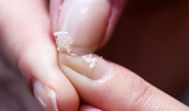 Kỹ sư nổi tiếng 36 tuổi bị đột tử và câu chuyện của anh có thể thức tỉnh tất cả mọi người-5