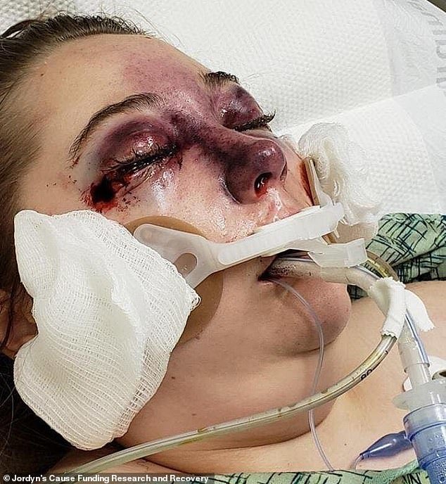 Nữ sinh 15 tuổi đột nhiên bị mù mắt sau chuyến du lịch-2