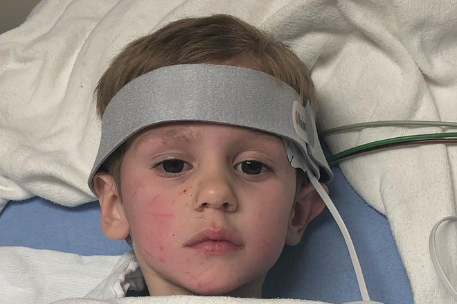 Bé 3 tuổi lạc trong rừng mưa lạnh suốt 2 ngày, khi được tìm thấy cậu nói đã đi chơi với gấu và mọi người tin câu chuyện này-2