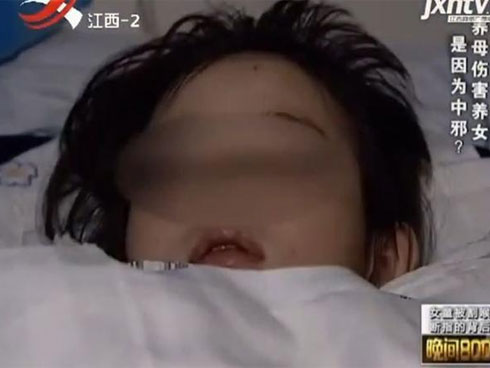 Đừng chủ quan với cảm cúm, cảm lạnh thông thường, chúng có thể giết chết bạn trong tích tắc rất đáng sợ-6