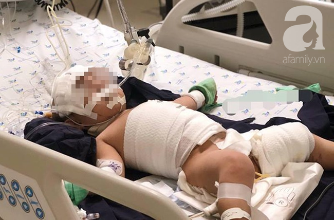Tai nạn kinh hoàng cận Tết: Cầm bút chì chơi rồi vấp ngã, bé gái 6 tuổi bị đâm xuyên từ mũi đến hốc mắt-8