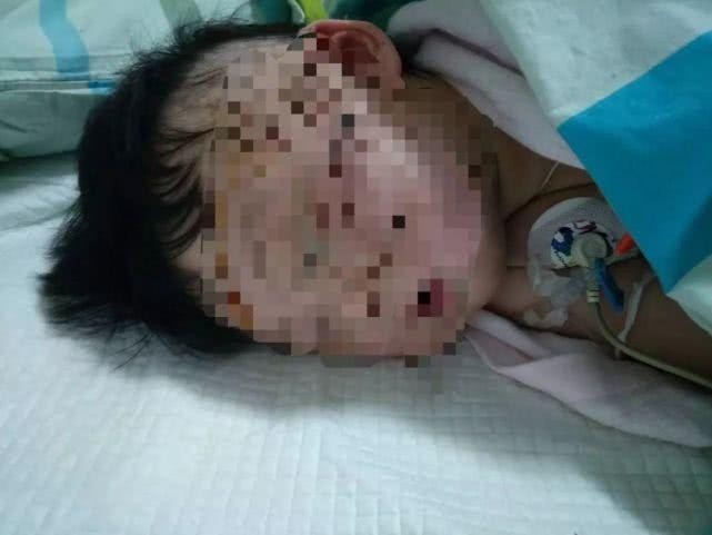 Đưa cháu gái đi phơi nắng, trong một lúc sơ hở bà quay lại nhìn thấy cháu biến dạng và nhận ra thủ phạm ở ngay bên cạnh-1