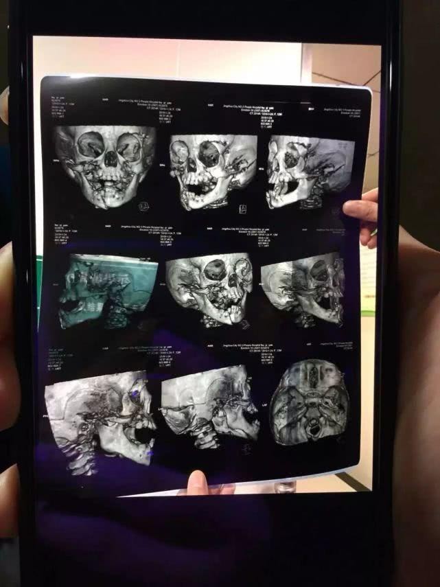 Đưa cháu gái đi phơi nắng, trong một lúc sơ hở bà quay lại nhìn thấy cháu biến dạng và nhận ra thủ phạm ở ngay bên cạnh-2