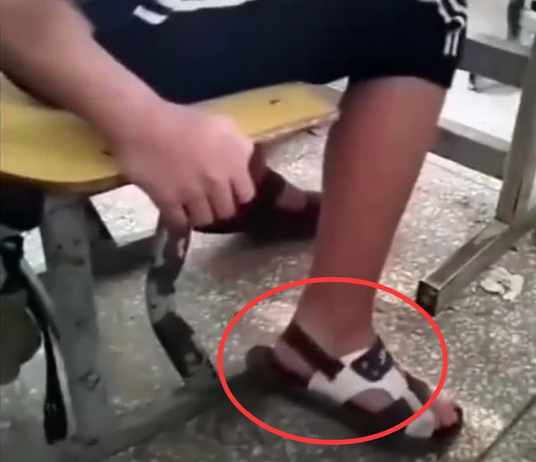 Nhỡ đi dép bệt trong khi trường bắt mang quai hậu, nam sinh này đã đối phó theo cách không ai ngờ đến-3