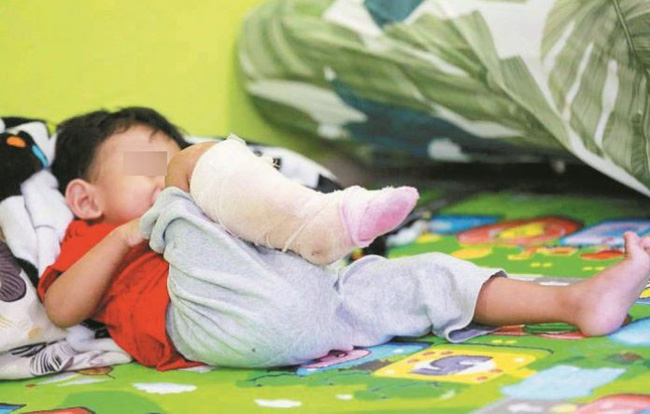 Con bị nhiễm vi khuẩn ăn thịt người, mẹ hối hận tột độ vì đã phớt lờ điều tưởng chừng như vô hại này-2