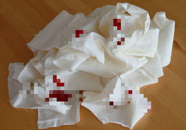 Người phụ nữ bị rách vùng kín gần 10cm sau khi lên nhầm giường” với đồng nghiệp-2