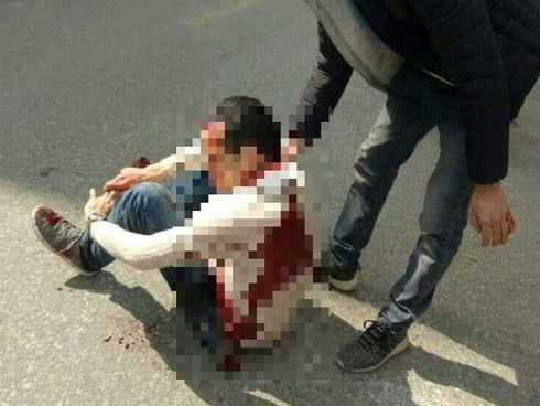 Người dân hoang mang sau khi đưa nam thanh niên bị đâm trọng thương đi cấp cứu vì nạn nhân nhiễm HIV-3