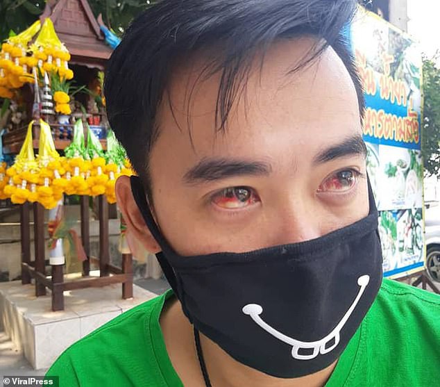 Thái Lan: Ô nhiễm quá nặng tại Bangkok khiến nhiều người dân ho ra máu-3