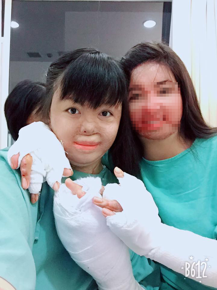 Người vợ xinh đẹp bị chồng đốt ngày mùng 2 Tết giờ ra sao?-3