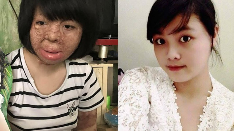 Người vợ xinh đẹp bị chồng đốt ngày mùng 2 Tết giờ ra sao?-1