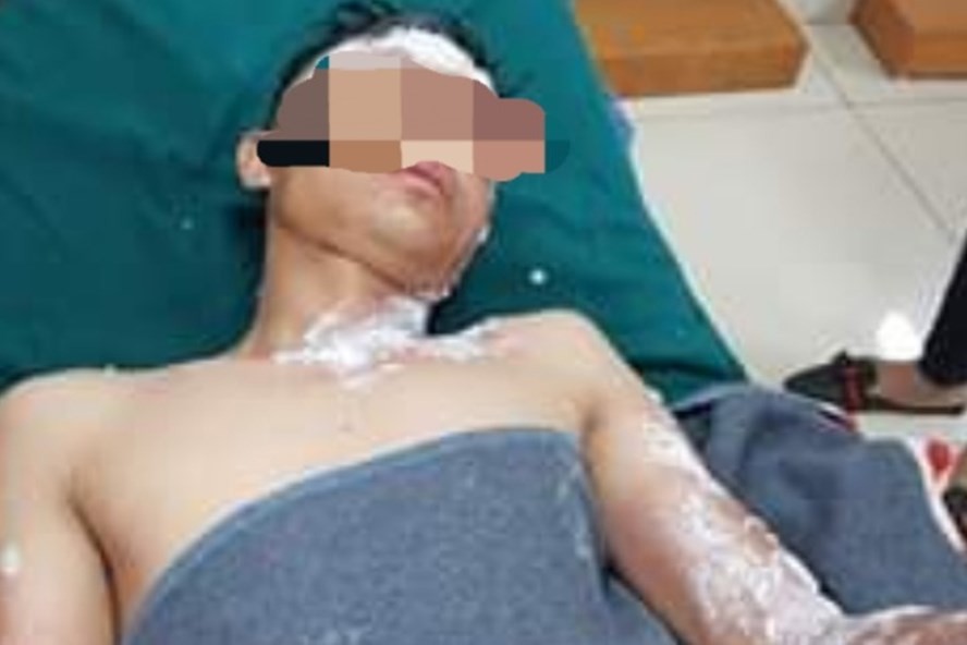 Quảng Bình: Nhiều người nhập viện cấp cứu do đốt pháo trái phép-1