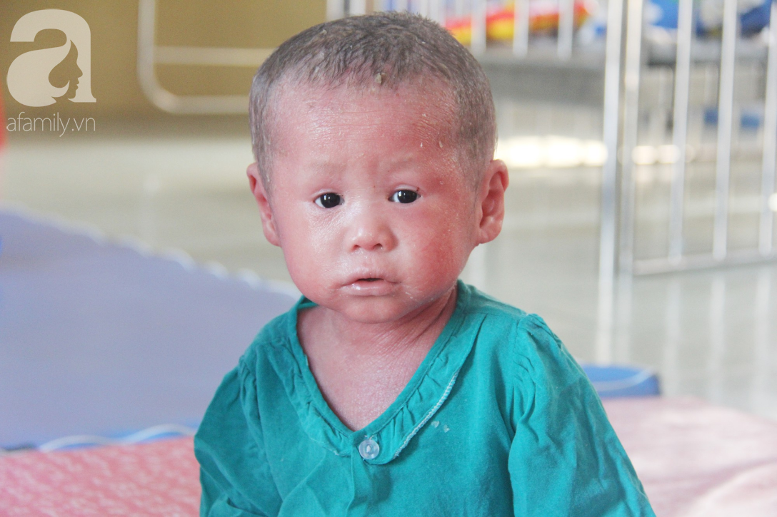 Hình ảnh ấm áp năm mới: bé Bích bị bỏ rơi, người đầy vẩy ngứa như da trăn ngày nào đã tập đi, tập nói-1