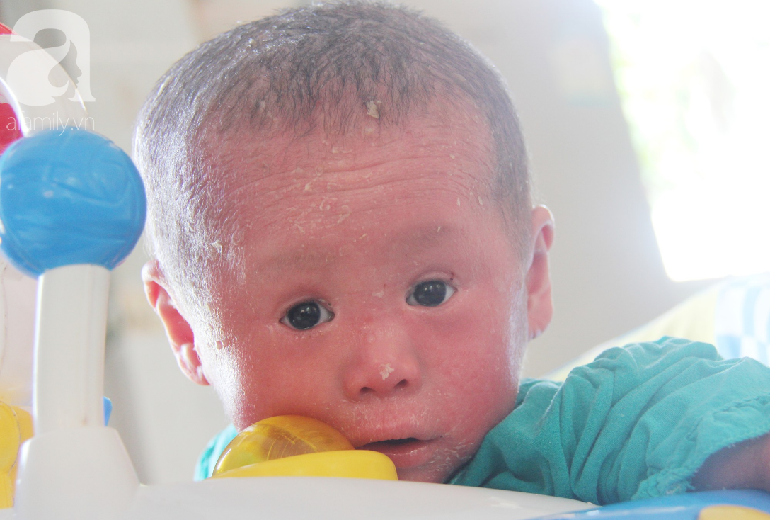 Hình ảnh ấm áp năm mới: bé Bích bị bỏ rơi, người đầy vẩy ngứa như da trăn ngày nào đã tập đi, tập nói-9