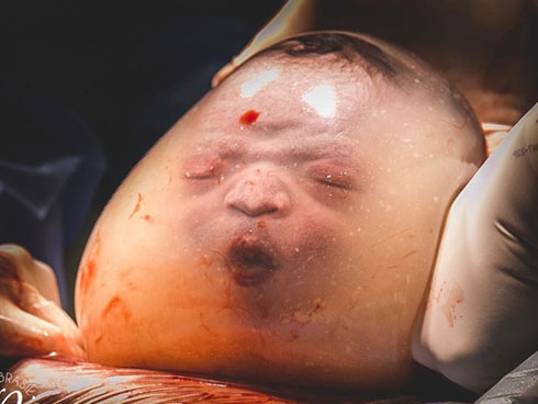 Bé trai trong bức ảnh sinh ra vẫn đang nằm nguyên trong túi ối” từng gây chấn động thế giới vài năm trước giờ ra sao?-10