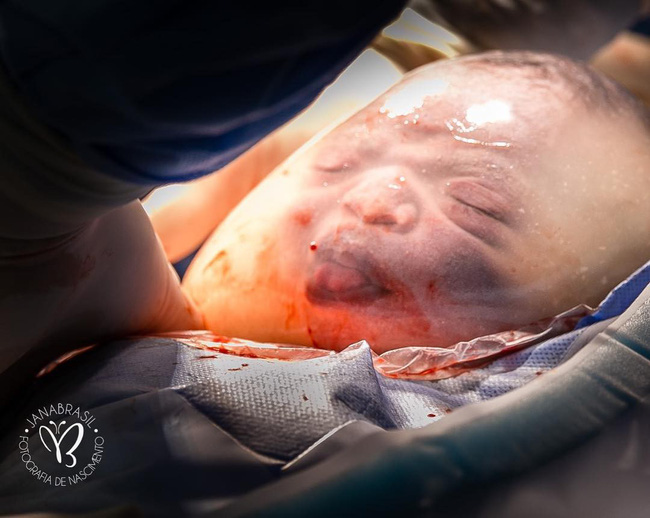 Em bé nổi như cồn” vì vừa nằm trong túi ối vừa làm trò, hết chu mỏ đến thè lưỡi trêu chọc mọi người-5