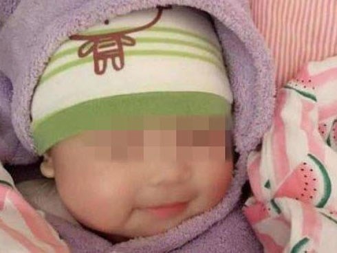 Bé 6 tháng thường cười khi ngủ, bà khen đáng yêu nhưng mẹ đưa đi khám thì hối hận