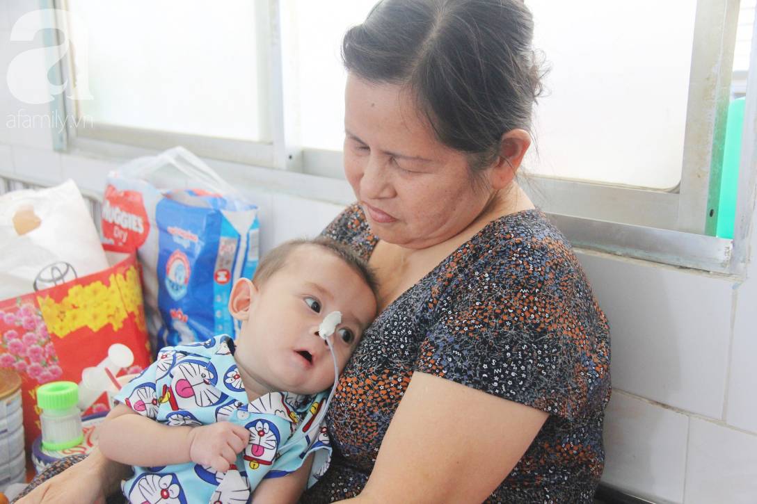 Ánh mắt cầu cứu của bé trai 7 tháng tuổi bị mẹ bỏ rơi trước cổng chùa vì mắc bệnh bại não-1