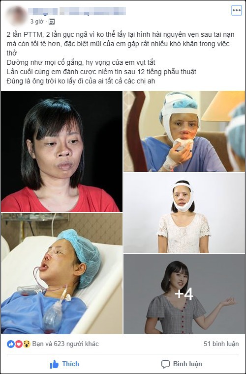 Tai nạn trên đường đi lấy bằng tốt nghiệp khiến khuôn mặt biến dạng, cô gái quyết tâm lột xác và thành quả đầy bất ngờ-1