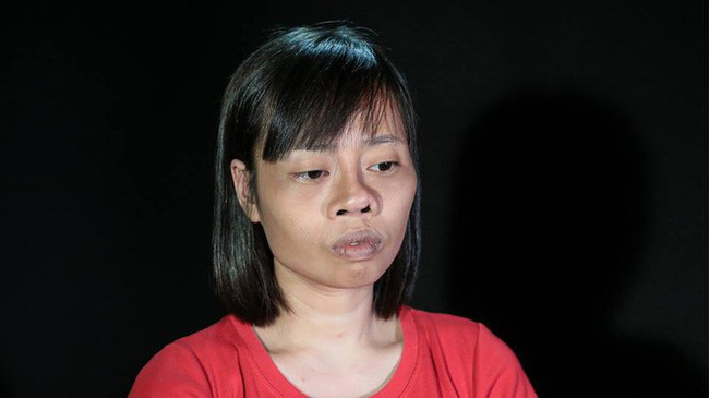 Tai nạn trên đường đi lấy bằng tốt nghiệp khiến khuôn mặt biến dạng, cô gái quyết tâm lột xác và thành quả đầy bất ngờ-2