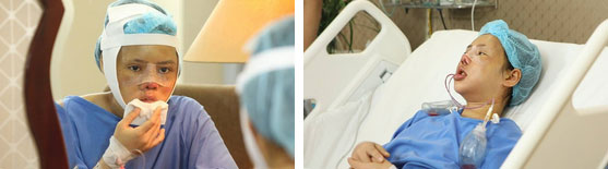 Tai nạn trên đường đi lấy bằng tốt nghiệp khiến khuôn mặt biến dạng, cô gái quyết tâm lột xác và thành quả đầy bất ngờ-3