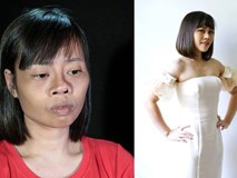 Tai nạn trên đường đi lấy bằng tốt nghiệp khiến khuôn mặt biến dạng, cô gái quyết tâm "lột xác" và thành quả đầy bất ngờ Tai nạn trên đường đi lấy bằng tốt nghiệp khiến khuôn mặt biến dạng, cô gái quyết tâm "lột xác" và thành quả đầy bất ngờ