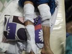 Việt kiều bị tạt axit ngày Tết: Anh trai nạn nhân rời quê bất thường-3