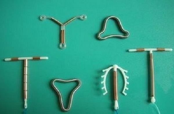 Từ trường hợp vòng tránh thai đi lạc 10 năm trong cơ thể người phụ nữ: Có nên tránh thai theo cách này?-3
