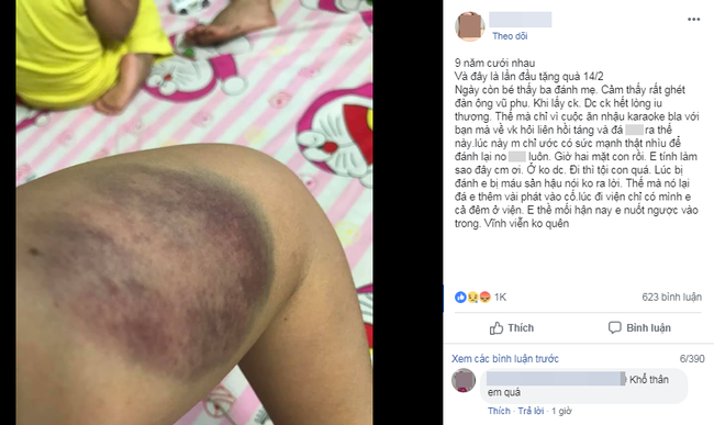 Hội chị em xót xa cho người vợ cưới 9 năm, lần đầu được chồng tặng quà lễ Tình yêu là trận đòn tím tái-1