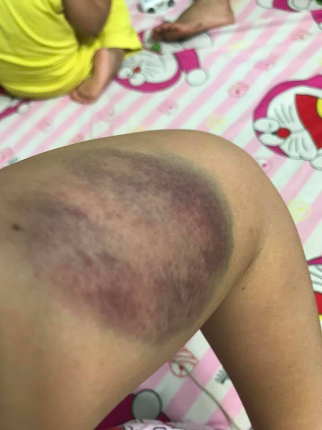 Hội chị em xót xa cho người vợ cưới 9 năm, lần đầu được chồng tặng quà lễ Tình yêu là trận đòn tím tái-2